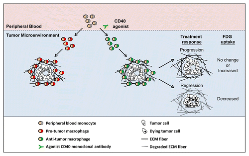 Figure 1. Re-directing the phenotype of tumor-infiltrating macrophages induces the regression of pancreatic adenocarcinoma lesions. Peripheral blood monocytes are routinely recruited to neoplastic lesions, where they can support tumor growth and development. The systemic administration of an agonist CD40 antibody shifts the phenotype of tumor-infiltrating macrophages from pro-tumor to anti-tumor. Anti-tumor macrophages induce the regression of some malignant lesions by eliminating cancer cells and degrading the extracellular matrix (ECM) that generally surrounds tumors. Tumor response is associated with changes in glucose metabolism as measured by [18F]-fluorodeoxyglucose (FDG) uptake detected on positron emission tomography/CT (PET/CT) imaging.