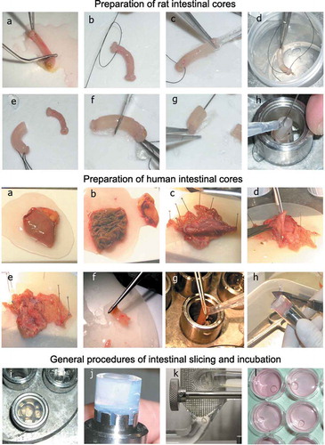 Figure 2. Preparation and incubation of rat and human intestinal slices. Upper panel (a–h): preparation of rat intestinal cores. After the fecal contents are removed from the intestinal segment (a), one side is tied (b). The segment is filled with liquid agarose solution at 37°C (c) and cooled (d) to form a filled cylinder about 5 mm thick (e). After cutting the segments into two halves (f), a pin is placed in the filled lumen (g) to fix the segment in the precooled cylindrical mold plunger (h). The mold is then filled with agarose solution at 37°C. Middle panel (a–h): preparation of human intestinal cores. (a) Piece of human jejunum. Fat tissue is removed and the intestine is opened (here the mucosal side is facing upward) (b). The segment is then fixed on a silicone mattress on the precooled tissue-embedding unit with pins (c) and the muscular is gently cut (stripped) away (d, e). Thereafter, the stripped intestine is cut into pieces of approximately 10 × 20 mm (f) and embedded with low-gelling agarose (g, h). Lower panel (i–l): slicing and incubation of rat precision-cut intestinal slices. Agarose cooled in the mold (i). The plunger is removed from the mold and transferred to the Krumdieck tissue slicer (j). Slices of 2–4 mg in wet weight are cut (k) and incubated in 12-well plates (l). Reproduced with permission from [Citation29].