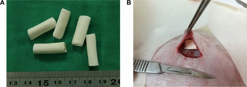 Figure 5 The implantation of drug-eluting grafts into the subcutaneous pockets of rabbits.Notes: (A) The drug-eluting graft was cut into 2 cm in length. (B) The implantation of drug-eluting grafts into the subcutaneous pockets of rabbits.