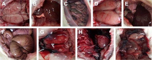 Figure 8 Bleeding status of DVT rats treated with 3 mL/kg/day of CMC-Na, 36 μmol/kg/day of DEBIC and 0.82 μmol/kg/day of warfarin for 7 consecutive days, n=12. Notes: Bleeding status of DVT rats treated with CMC-Na (A: brain, B: chest, C: abdomen); bleeding status of DVT rats treated with DEBIC (D: brain, E: chest, F: abdomen); bleeding status of DVT rats treated with warfarin (G: brain, H: chest, I: abdomen).Abbreviations: CMC-Na, carboxymethyl cellulose sodium; DEBIC, dimethyl 2,2′-[2,2′-(ethane-1,1-diyl)bis(1H-indole-3,2-diyl)]diacetate; DVT, deep vein thrombosis.