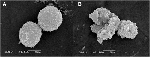 Figure 11 Morphological changes in leukemia K562 cells were observed by SEM after Melectin treatment. (A) K562 cells treated with PBS buffer were used as negative controls; (B) K562 cells treated with 10 µM Melectin for 30 min.