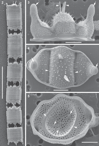 Figs 2–5. Morphology of representative vegetative frustules and valves, scanning electron microscopy (SEM). Fig. 2. Clone PLB-B3; shows six frustules in a chain. Fig. 3. Clone PLB-B3; shows girdle view of valve, pseudocelli (arrows) and external tubes of the rimoportulae (arrowheads). Fig. 4. Clone Mex-A; shows external valve surface, valve outline, pseudocelli (arrows), spines scattered on valve face, hyaline area of the valve where the valve face is indented (arrowheads), and pores. Fig. 5. Clone PLB-B3; internal view of valve, openings of the rimoportulae (arrows) and a hyaline ring corresponding to a circular indentation present in small valves with nearly circular outline (arrowheads). Scale bars: Fig. 2, 100 µm; Figs 3–5, 10 µm.
