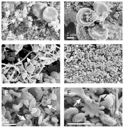 Figure 2 Scanning electron micrograph of chosen regions of an isolate from peripheral blood of a healthy human donor (male, 28 years). In addition to numerous nanoparticles which are present in all the pictures, erythrocytes (A – black arrow, B), activated platelets (A – white arrow), tubules (C), tori (E – white arrows), starfish (F – black arrow) and a deformed erythrocyte exhibiting protrusion with a bulbous end (F – white arrow) were observed. (A – D) images taken using a LEO Gemini 1530 (LEO, Oberkochen, Germany) scanning electron microscope by applying 8 kV (A, C, and D) and 2.7 kV (B), at Åbo Akademi University, Åbo/Turku. Images E and F taken by Quanta TM 250 FEG (FEI, Hillsboro, Oregon, OR) scanning electron microscope at FEI Quanta, Eindhoven, The Netherlands, by applying 1.5 kV.