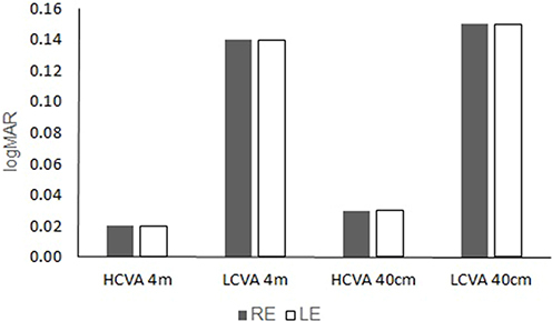 Figure 1 Monocular distance and near contrast visual acuity.