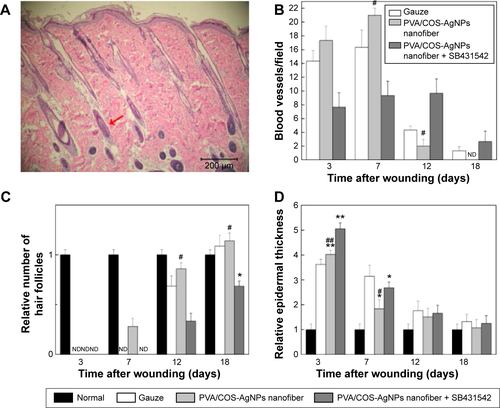 Figure S1 The histology of normal skin and the histologic associated comparison of the three groups.Notes: (A) The HE staining of normal skin. The arrows colored with red indicates hair follicles. (B) The number of blood vessels of the same multiples’ field (×100) in normal, gauze, PVA/COS-AgNPs nanofiber, PVA/COS-AgNPs nanofiber plus SB431542 at 3, 7, 12, 18 days post-wounding. (C) The relative number of hair follicles in normal, gauze, PVA/COS-AgNPs nanofiber, PVA/COS-AgNPs nanofiber plus SB431542 at 3, 7, 12, 18 days post-wounding. (D) The relative thickness of the epidermis in normal, gauze, PVA/COS-AgNPs nanofiber, PVA/COS-AgNPs nanofiber plus SB431542 at 3, 7, 12, 18 days post-wounding. Values are mean ± standard deviation. *P<0.05 and **P<0.01 vs normal group, #P<0.05 and ##P<0.01 vs PVA/COS-AgNPs nanofiber plus SB431542 group.Abbreviations: PVA, poly(vinyl alcohol); COS, chitosan oligosaccharide; AgNPs, silver nanoparticles; ND, no data; HE, hematoxylin–eosin.