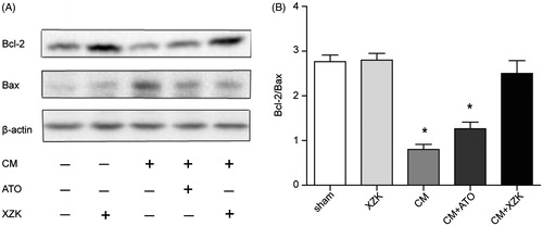 Figure 4. (A) Bax and Bcl-2 protein expression by Western blotting. (B) The ratio of Bcl-2/Bax expression. *p < 0.01 versus group sham, group XZK and group CM + XZK. Western blots were repeated at least by three independent times.