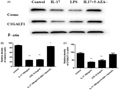 Figure 5. IL-17 decreased C1GALT1 and Cosmc protein expression in DAKIKI cells. Cells were stimulated with 160 ng/mL IL-17. Stimulation with 12.5 (g/mL LPS was the positive control, and 1.0 μmol/L 5-AZA+160 ng/mL IL-17 or medium was the negative control. (A, B) IL-17 decreased Cosmc protein expression compared with the negative control, although the effect was stronger than that of LPS. (A, C) IL-17 significantly decreased C1GALT1 protein expression compared with the negative control, although the effect was stronger than that of LPS. *p < .05 compared with control; **p < .01 compared with control.