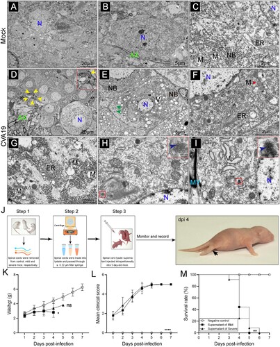 Figure 5. Ultrastructure of spinal cord neurons after CVA19 infection. Inoculation of lysis supernatants of spinal cords from infected mice leads to limb paralysis in 3-day-old mice. (A–C) Ultrastructure of uninfected spinal cord neurons. Intact nuclear (N); Endoplasmic reticulum (ER); Mitochondria (M); Axon (AX); Nissl’s bodies (NB). (D–I) Ultrastructure of infected spinal cord neurons. Pyknotic nucleus and indistinguishable indented nuclear membrane (D, yellow arrows); Disappearance or decrement of Nissl substance (E, green arrows). Relatively dense atrophic mitochondria (F, red arrow). ER with swollen cisternae, dilation and irregular arrangement of mitochondrial cristae (F and G). CVA19 particles in infected neurons (H and I, blue arrows). Vacuoles (V); Myelin sheath (MY). The scale bar has been indicated in the figures. (J) The procedure of the experiment and the production steps of the spinal cord lysate supernatant. The black arrow indicated typical paralysed limbs. The weight (K), clinical manifestation (L), and survival rates (M) were monitored and recorded daily until 7 dpi. The Mantel–Cox Log-rank test was used to compare the survival rates of mice in different groups. The variance analysis was conducted by a two-tailed Student’s t-test on performing the comparison of two groups. Data represent the mean ± SD. Different groups vs negative control, *P < 0.05, **P < 0.01, ****P < 0.0001; ns, non-significant.