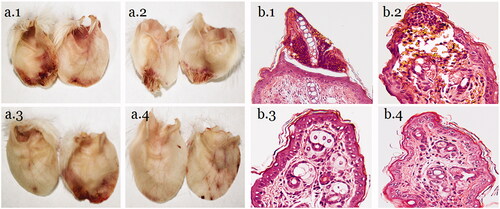 Figure 5. Morphology of mouse ear tips (a) and histology of HE-stained mice ear tips (b). (1) Model + NS group; (2) low-dose AAFC-CDs group; (3) middle-dose AAFC-CDs group; and (4) high-dose AAFC-CDs group.