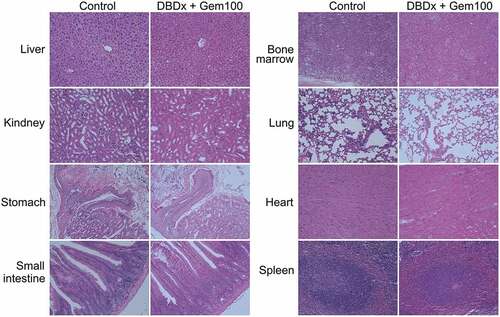 Figure 2. Histopathological examination of various organs from mice treated with saline or DBDx + Gem100. No toxicological damages were found in liver, kidney, stomach, intestine, bone marrow, lung, heart and spleen in DBDx-treated animals (H&E). (×200).