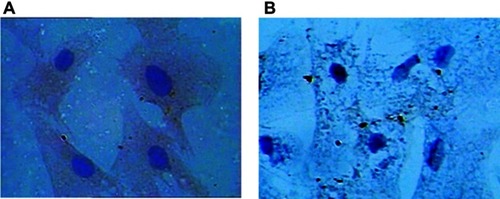 Figure 2 (A) Immunocytochemistry image of RPAs is polygonal and spindle-shaped cells presenting typical “paving-stone” and “pebbles” growth with blue ovoid nuclei in the center, anti-von Willebrand cellular immune staining showing that cytoplasm is tan positive (400×). (B) Negative control.