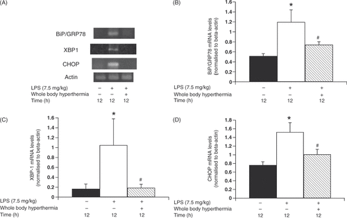 Figure 4. Change in ER stress response gene levels in pancreatic beta cells due to whole-body hyperthermia treatment prior to LPS administration. Rats were treated with LPS following exposure to either 42 °C or ambient temperature. Pancreatic beta cells were harvested and transcripts were analysed by polymerase chain reaction (PCR) and quantified by densitometry. (A) Levels of BiP/GRP78, XBP-1, and CHOP transcripts in cells from LPS-treated rats were determined by RT-PCR. Signal intensities of BiP/GRP78 (B), XBP-1 (C), and CHOP (D) transcripts were based on densitometry using an image analyser. All data are expressed as the mean ± SD. # denotes a significant difference compared to the LPS group (p < 0.05); * denotes a significant difference compared to the negative control group (p < 0.05).