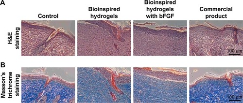 Figure 7 Histological images of H&E (A) and Masson’s trichrome (B) stained sections after 14 days of wound healing.Abbreviation: bFGF, basic fibroblast growth factor.