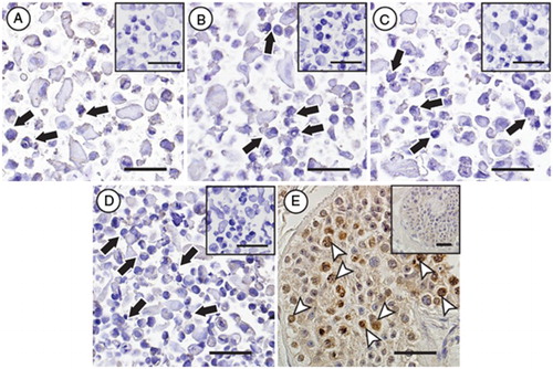 Figure 5.  Immunocytochemical evaluation of DDX4 expression in hESC lines. No specific protein expression of DDX4 could be observed in any of the evaluated stem cells lines (black arrows, H9 (A), HS207 (B), HS360 (C) and HS401 (D)), whereas positive protein expression of DDX4 (white arrow heads) could be observed in male germ cells in cross-sections of a human testicular biopsy (E). Negative controls for the primary antibody for all samples are shown as small Figures (A-E). Scale bars: 50µm.