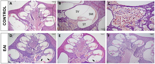 Figure 3. HE staining of cochlear sections. (A) Typical morphology of the cochlea at 4x magnification. The dashed area is the middle turn of the cochlear. (B) The middle turn of the cochlear at 10× magnification. SV: Scala Vestibuli; SM: Scala Media; ST: Scala Tympani. (C) Spiral ganglion neurons are nested in Rosenthal’s canal at 40× magnification. (D, E, F) Cochlear morphology on postoperative Day 7 (D), Day 14 (E), and Day 28 (F). The arrows mark exudates and newborn fibrous tissue. The placement of the asterisk is the fibrous sheath.
