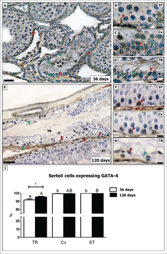 Figure 5. Evaluation of GATA-4 immunostaining in different testicular areas of pre-pubertal (A–D) and adult (E–H) Wistar rats. Images showing the seminiferous tubules (ST; B and F), the area adjacent to the transition region (Cx; C and G) and the transition region (TR; D and H). Positive and negative Sertoli cells are indicated respectively by red and green arrowheads. In TR, about 8% of Sertoli cells do not express GATA-4 in pre-pubertal rats. In adults, the percentage of GATA-4 negative Sertoli cells are reduced by half (4%; p < 0.05) (I). In the Cx (B, G), few GATA-4 negative Sertoli cells were found in both young and adult rats (less than 1%). Bar: 50 μm (A and E); 10 μm (B-D, F-H). Different small and capital letters represent statistically significant differences between regions (TR, ST or Cx) respectively of young and adult rats (p < 0.05). Considering the same region, statistically significant differences (p < 0.05) were observed only for TR.