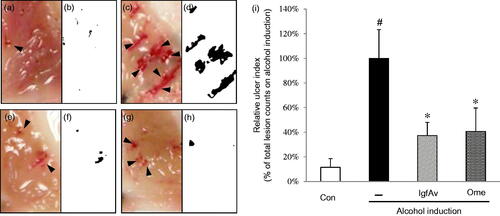 Figure 2. Gastroprotective effects of Aloe vera gel fraction on mucosal tissues in alcohol-induced acute gastric lesion model. Mice were randomly divided into (a and b) control, (c and d) alcohol alone (8 mL/kg), (e and f) gel (150 mg/kg) and (g and h) omeprazole (3 mg/kg) with alcohol treatment (8 mL/kg; n = 7). After oral (p.o.) administration, mice were returned to their cages for 30 min to apply drug metabolism. Mice were not allowed food or water during alcohol induction. Mice were euthanized, and the tissues were anatomically examined for visible signs such as scars or clumps of blood caused by ulcer, or both. (i) Gastric lesion index was measured and expressed relative to intensity of control. Gastric lesions were counted as described in Materials and methods section. Data are mean ± standard deviation (SD, n = 7 animals/group). #p < 0.05 and *p < 0.05 compared with control and alcohol-administered group, respectively. Results were analysed using multiple range Dunnett′s test. Con: control; –: alcohol induction alone; lgfAv: low molecular-weight fraction of Aloe vera; Ome: omeprazole. Each image (a–h) is divided into two parts: clinical observation and image analysis (see Materials and Methods for details).