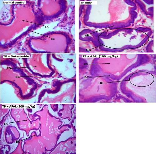 Figure 6. Micrograph of prostates in the experimental rats (Stain: H & E; Magnification: ×400). TP = testosterone propionate, AFAL = acetogenin-rich fraction of A. muricata leaves, ES = eosinophilic secretion, BC = basal cell and HG = hyperplastic gland.