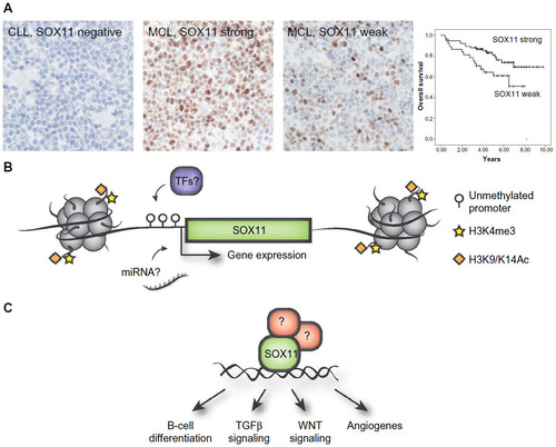 Figure 1 Overview of the diagnostic, prognostic, and regulatory role of SOX11.