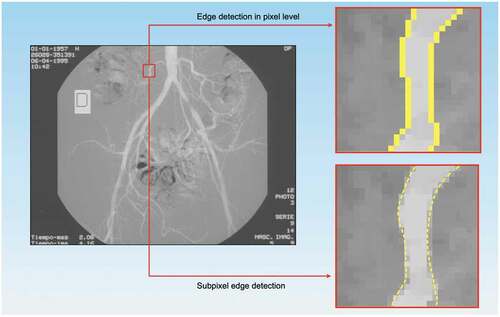 Figure 8. Subpixel edge detection where edges are precisely located inside the pixels. Credits: (Trujillo-Pino et al. Citation2013).