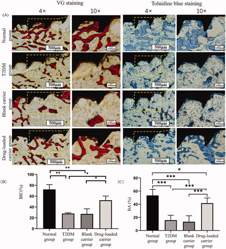 Figure 6. (A) The images of the undecalcified sections stained with VG staining and toluidine blue staining under light microscopy. (B) Statistical results of the BIC; (C) Statistical results of BA. Scale bar = 500 μm (magnification ×4). Scale bar = 100 μm (magnification ×10). *p<.05; **p<.01; ***p<.001.