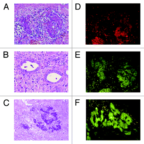 Figure 3. Histological analyses of intestinal segments in pigs. Intestinal segments were sampled on postoperative day 7. (A) Hepatocyte cluster in the submucosa (HE, x400). (B) Bile duct-like structure in the submucosa (HE, x400). (C) Glycogen in the hepatocytes (PAS, x200). (D) Immunohistochemical staining for albumin (x400). (E) Immunohistochemical staining for CYP1A1 (x400). (F) Immunohistochemical staining for OV-6 (x400).