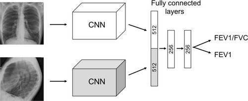 Figure 3 Image model architecture. The frontal and lateral images are inputs to two parallel convolutional neural networks (CNN) trained with annotation data from pulmonary function tests (PFTs). The outputs of the model are the PFT values FEV1/FVC and %predFEV1. The FEV1/FVC ratio is the percentage of the total amount of air that can be exhaled from the lungs during the first second of forced exhalation. FEV1 is the amount of air that can be forcibly exhaled from the lungs in the first second of a forced exhalation, while %predFEV1 is the FEV1 expressed as percent predicted value.