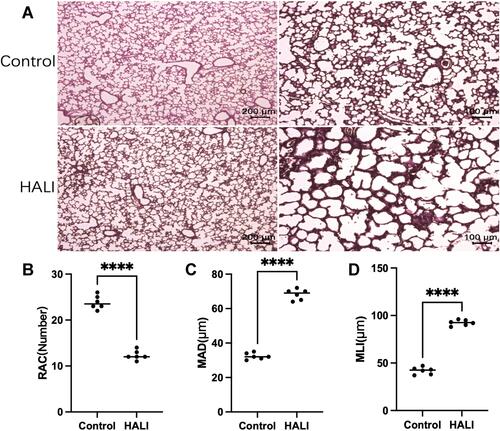 Figure 1 (A) In HE staining, the lung tissue structure in the HALI group showed a decrease in the number of alveoli, an increase in the volume of the alveolar cavity, and a thickening of the alveolar septa compared with the control. Scale bars = 200 μm, 100 μm. (B) Semi-quantitative pathology score of RAC in lung tissues. (C) Semi-quantitative pathology score of MAD in lung tissues. (D) Semi-quantitative pathology score of MLI in lung tissues. The values are the mean ± SD; n = 6 nonoverlapping fields/group; ****P < 0.0001.