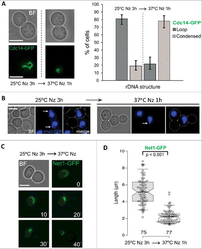 Figure 1. The rDNA metaphase loop gets condensed upon heat stress (HS). (A) Strain FM230 (CDC14:GFP, YPH499 background) was blocked in metaphase with Nocodazole (Nz) for 3h at 25 ºC and then shifted to 37 ºC for 1 h. Samples were taken and visualized under the fluorescence microscope before and after the temperature shift. Representative photos are shown on the left and a quantification chart on the right. (B) Strain yED233 (HTA2:yEmCFP) was Nz-blocked at 25 ºC and then shifted to 37 ºC for 1 h. Representative photos are shown before and after the temperature shift. White arrows point to the metaphase loop seen with the HTA2-CFP histone signal. (C) Strain FM225 (NET1:GFP, YPH499 background) was Nz-blocked for 3h at 25 ºC before being sawed onto an agarose patch with Nz and filmed while cells were being heated up to 37 ºC. A representative cell filmed in 10 min intervals during this HS time-lapse is shown. (D) Strain FM931 (OsTIR1 NET1:GFP, W303 background) was Nz-blocked at 25 ºC and then shifted to 37 ºC for 1 h. Box plot of the quantification of the length of the loop, the line or the major axis of the oval shape (when neither a loop nor a line could be inferred) before and after the HS. White scale bars represent 5 μm. BF, bright field; Nz, nocodazole.