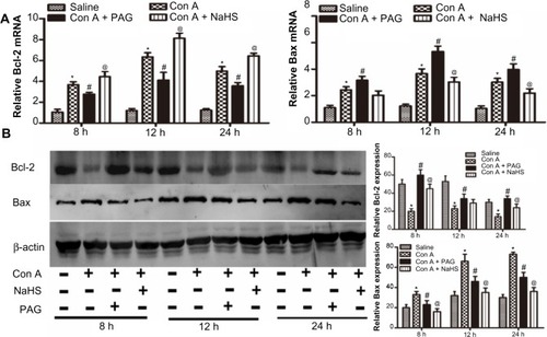 Figure 3 H2S attenuates hepatocyte apoptosis in Con A-induced hepatitis in mice.Notes: (A) Real-time PCR evaluation of mRNA expression of Bcl-2 and Bax in liver tissues. *P<0.05 for saline vs Con A, # P<0.05 for Con A vs Con A + PAG, @ P<0.05 for Con A vs Con A + NaHS (14 μm/kg). (B) Western blots and quantitative evaluation of the expression of Bcl-2 and Bax in liver tissues. *P<0.05 for saline vs Con A, # P<0.05 for Con A vs Con A + PAG, @ P<0.05 for Con A vs Con A + NaHS (14 μm/kg).