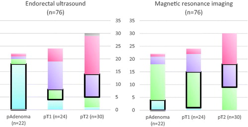 Figure 2. Diagrams showing the T-staging accuracy of ultrasound (left) and magnetic resonance imaging (MRI) (right), based on the 76 patients with conclusive results from both MRI and endorectal ultrasound (ERUS). Correctly staged tumors are marked with a thick line. Colors indicate tentative staging, with blue indicating adenomas, green cT1, purple cT2, red cT3, and gray cT4. ERUS overstaged 4 adenomas (2 T1, 1 T2, and 1 T3), 16 T1 tumors (11 T2 and 5 T3), and 16 T2 tumors (15 T3 and 1 T4). ERUS also understaged 4 T1 tumors and 5 T2 tumors (4 T1, 1 adenoma). MRI overstaged 18 adenomas (14 T1, 3 T2, and 1 T3), 9 T1 tumors (7 T2 and 2 T3) and 12 T2 tumors (12 T3). MRI understaged 1 T1 tumor and 9 T2 tumors (9 T1).