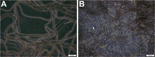 Figure 1 Inverted light micrographs of Nostoc Bahar M strain.Notes: (A) Barrel-shaped Nostoc trichomes. (B) Coccoid cells (arrow) surrounded by a sheath.