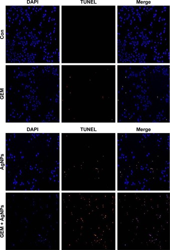 Figure 9 The effect of treatment with GEM, AgNPs, or a combination of GEM and AgNPs, on apoptosis in human ovarian cancer cells.Notes: The cells were treated with GEM (50 nM), AgNPs (50 nM), or a combination of GEM (50 nM) and AgNPs (50 nM), for 24 h. Apoptosis in human ovarian cancer cells after a 24-h treatment was assessed using the TUNEL assay; the nuclei were counterstained with DAPI. Representative images show apoptotic (fragmented) DNA (red staining) and the corresponding cell nuclei (blue staining).Abbreviations: AgNP, silver nanoparticle; Con, control; GEM, gemcitabine.