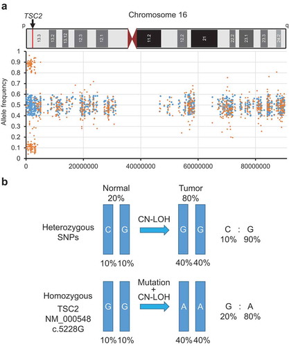 Figure 3. Copy-neutral loss of heterozygosity (CN-LOH) in chromosome 16.