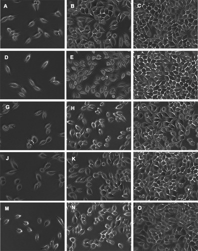 Figure 9 Cell morphology in each group after 1 (A, D, G, J, M), 3 (B, E, H, K, N) and 5 (C, F, I, L, O) days of cell culture. (A–C): L-55si+5Zr group; (D–F): L-55si+5Mzr group; (G–I): D-50si+10zr; (J–L): D-50si+10Mzr; and (M–O): control group.