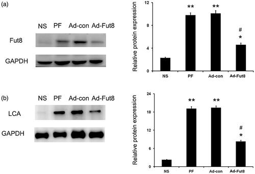 Figure 2. Fut8shRNA effectively inhibited Fut8 expression, and EGF receptor is modified by core fucosylation: (a) representative Western blot images and analyses of Fut8 in the normal saline (NS), peritoneal fibrosis (PF), adenovirus-control (Ad-con), and adenovirus-Fut8 (Ad-Fut8) groups; (b) representative Western and lectin blot analysis and quantification of the core fucose levels of the EGF receptor in the four groups. EGF receptor was immunoprecipitated from tissue lysates and then subjected to electrophoresis. After electroblotting, blots were probed by Lens culinaris agglutinin (LCA)–Biotin. Results are expressed as mean ± SEM of eight rats per group. *p < 0.05, **p < 0.01 vs. NS group. #p < 0.05 each group (except for NS group) vs. both PF and Ad-con group.