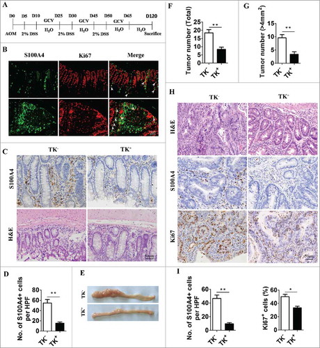 Figure 3. Selective depletion of proliferating S100A4+ cells decreases colorectal tumorigenesis. (A) Schematic illustration of S100A4+ cell depletion in S100A4-TK transgenic mice and control littermates. (B) Proliferating S100A4+ cells in DSS-treated colon. Double staining of S100A4 (green) and Ki67 (red) in DSS-treated colon tissues. The arrows indicate double-positive cells that are proliferating. Scale bar, 50 μm. (C) Groups of S100A4-TK transgenic mice (TK+) and control littermates (TK−) (n = 8–10) were treated with GCV to deplete S100A4+ cells or PBS as the control. Shown is the staining for S100A4 and H&E in colon tissue. Scale bar, 50 μm. (D) Percentages of S100A4+ cells of GCV-treated mice are shown. *P < 0.05, **P < 0.01. (E) Representative photographs of the colon from S100A4−/− and WT mice on day 120 of age. (F) Tumor incidence and incidence of tumors over 4 mm2 (G) in S100A4 Tk+ and S100A4 TK− mice are shown. (H) Colon sections were stained with H&E, S100A4 and Ki67. Scale bar, 50 μm. (I) The number of S100A4+ cells in tumors per HPF and percentages of Ki67+ cells in tumors are shown.