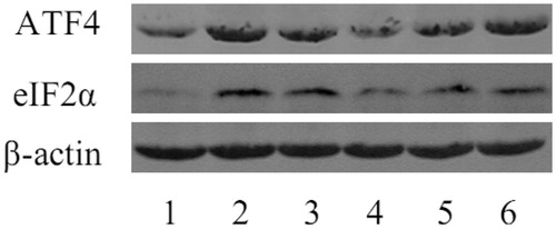 Figure 9. Western blot analysis of eIF2α and ATF4 protein levels. Lane 1 represents the data as mean ± SEM, from sham treated group; lane 2 from model group; lane 3 from enalapril group; lane 4 from high-dose resveratrol group; lane 5 from middle-dose resveratrol group and lane 6 from low-dose resveratrol group. Top panel represents an expression by western blot from the kidney lysates isolated, from different treatment groups. Bottom panel represents β-actin protein expression and is an internal control for equal loading of protein.