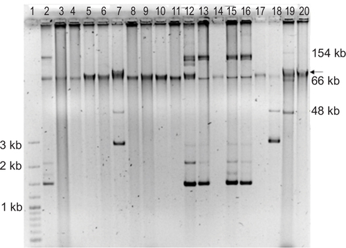 Figure S2 Plasmid extraction by the Quick Prep method of 17 clinical blaIMP-carrying P. aeruginosa isolates.