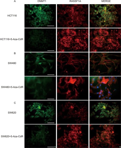 Figure 5 5-Aza-CdR can improve the expression of DNMT1 and RASSF1A proteins in colon cancer cells.Notes: (A) Immunofluorescence experiment results of HCT116 cells; (B) immunofluorescence experiment results of SW480 cells; (C) immunofluorescence experiment results of SW620 cells (400X, scale bar=25 μm) (n=6).