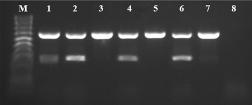 Fig. 1 Optimization of the TY2/TS1 primer pairs concentration used for mRT-PCR. The assay was performed using total RNA isolated from a Solanum lycopersicum plants previously confirmed to be co-infected with Tomato yellow ring virus (TYRV) and Tomato spotted wilt virus (TSWV). PCR fragments of 666 bp and 328 bp are specific for TYRV and TSWV, respectively. M – HyperLadder™ 100 bp (Bioline). Lanes 1–7 indicate the concentration combinations of primer pairs specific for TYRV and TSWV, respectively: (1) 0.2:0.2 μM, (2) 0.1:0.2 μM, (3) 0.2:0.1 μM, (4) 0.05:0.1 μM, (5) 0.1:0.05 μM, (6) 0.05:0.2 μM, (7) 0.2:0.05 μM. Line 8: negative control.