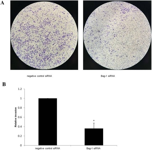 Figure 3 Effect of Bag-1 silencing on the inhibition of tumor cell invasion. A549 cells were grown and infected with lentivirus carrying Bag-1 or negative control siRNA for 48 hrs and then subjected to Transwell tumor cell invasion assay. (A) Invasion cells under a microscope. (B) the relative invasion rate. *p=0 0.011 vs the negative control siRNA group.