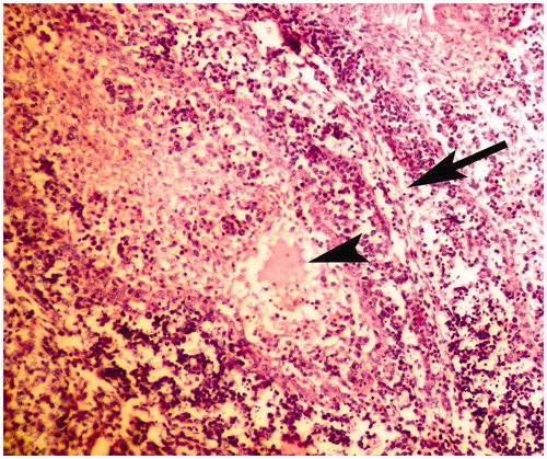Figure 2. Bursa of Fabricius of broiler chick administered chlorpyrifos (20 mg/kg BW) at post-treatment Day 15. Representative photomicrograph shows necrosis of follicle in the center, edema in the follicle (arrow heads), and proliferation of fibrous connective tissue around the lymphoid follicles (arrows). H&E stain. Magnification = 400×.