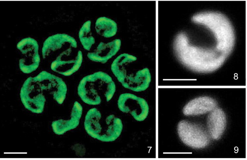 Figs 7–9. Confocal reconstructions of the chloroplast structure of Lunachloris lukesovae CCALA 307. Figs 7–8 mature vegetative cells. Fig. 9. autosporangium. Scale = 3 µm.