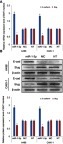 Figure 3 Increase of miR-1-3p level inhibited the origination of the EMT process in RCC cells. RT-PCR assay or Western blot assay were used to detect the (A) mRNA or (B) protein expression levels of the epithelial marker E-cadherin and the mesenchymal marker and transcription factor Slug in A498 or CAKI-1 cells. Results shown that mRNA or protein expression of E-cadherin was improved in the miR-1-3p group compared with control groups, although the mRNA or protein expression levels of Slug was decreased in A498 or CAKI-1 cells treated with miR-1-3p compared with control groups. (The first panel of (B) is a representative illustration of the results; n=3, *P<0.01 vs Non-Transfected cells).Abbreviations: EMT, Epithelial-mesenchymal transition, RCC, Renal cell cancer.