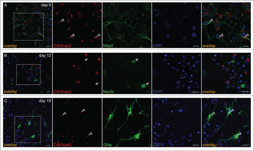 Figure 2. Cdk5rap2 in neurons and glial cells. Cdk5rap2 (red) was present in postmitotic cells immunopositive for (A) Map2 (green; marker for early neurons) and (C) Gfap (green; marker for glial cells), but not in (B) NeuN-positive cells (green; marker for mature neurons). Arrowheads, Cdk5rap2-positive centrosomes; arrows, NeuN-positive and Cdk5rap2–negative cells; confocal images, scale bars 10 μm.