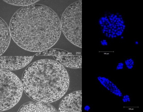 Figure 4. Different forms of C3A aggregates in alginate beads in link with mechanical properties: top corresponds to spherical spheroids formed in ‘soft’ scaffold whereas filaments like spheroids were obtained with stiffer gels.