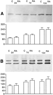 1 Western blot analysis of E-cadherin (A) and β-catenin (B) in HepG2 cells cultured for 2, 7, and 12 days in the absence (C) or presence of retinoic acid (RA). Densitometric evaluation of the bands, expressed as percentage of control at two days of culture, shows that the only increase is related to the time of culture, there being no significant differences between controls and RA-treated samples. Results are the average of at least four different experiments ±S.D.