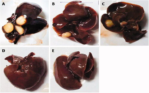 Figure 2. Macroscopical observation of DEN-induced HCC group rats. (A) DEN control group showed the expansion of hepatic nodules (white in color) and decolorization of tissue, (B) DEN control group treated with GA (25 mg/kg) illustrated the expansion of pre-cancerous nodules (white in color) and decolorization of tissue color, which was less as compared to DEN group, (C) DEN control group treated with GA (50 mg/kg) demonstrated the less pre-cancerous nodules (white in color) and decolorization of tissue color, (D) DEN control group treated with GA (100 mg/kg) illustrated the expansion of pre-cancerous nodules and decolorization of tissue color, which was less as compared to other group, and (E) DEN control group treated with GA-NLC (25 mg/kg) illustrated the decolorization of tissue color, which was less as compared to other group rats. Note: Normal control and normal control rats treated with GA (100 mg/kg) did not show any sign of precancerous cells and decolorization of skin (data not shown).