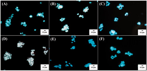 Figure 7. Overappled images of Hep G2 cells (106 cells mL−1, 1 ml) obtained after being incubated with POA-Au NPs at the concentations of (A) 0, (B) 62.5, (C) 125, (D) 250, (E) 500 and (F) 1000 µgmL−1 for 6 h, respectively obtained from dark field and fluorescence microscopy. The cells were stained by Hoechst 33342. The excitation wavelength was set at 330–380 nm and the exposure time was set to 10 ms.